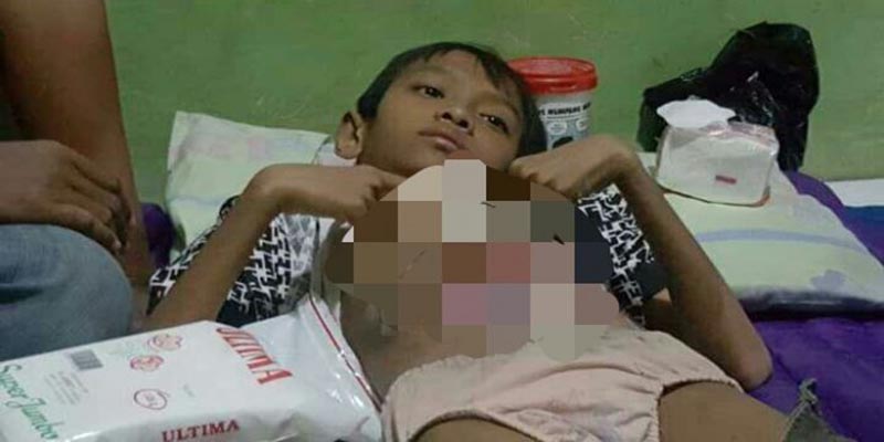 Kulit Perut Menipis hingga Usus Terlihat, Bocah Ini Butuh Bantuan