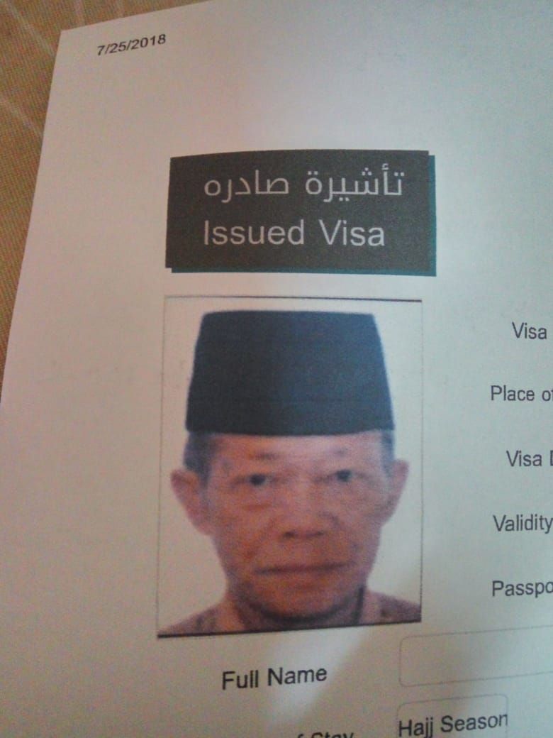 Terpleset Seusai Wudhu, JCH asal Jember Meninggal Di Madinah