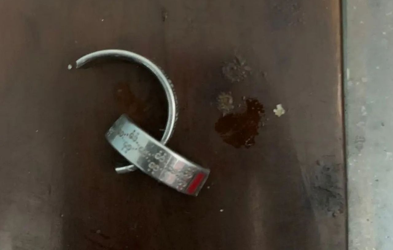Cincin berhasil dilepas setelah dibantu tim rescue (Foto: Damkar Sidoarjo)